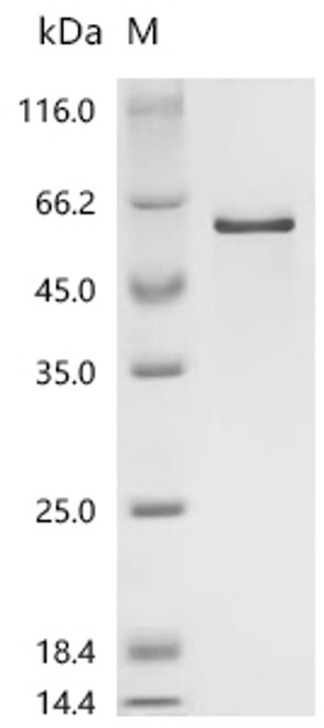 Recombinant Human Steroid hormone receptor ERR1 (ESRRA) (CSB-EP007834HUa0)