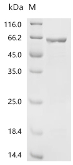 Recombinant Mouse Glial fibrillary acidic protein (Gfap) (CSB-EP009369MOa0)