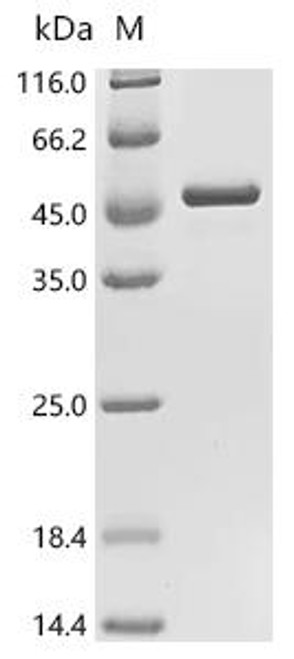 Recombinant Human Guanine nucleotide-binding protein G (q) subunit alpha (GNAQ) (CSB-EP342271HUc7)