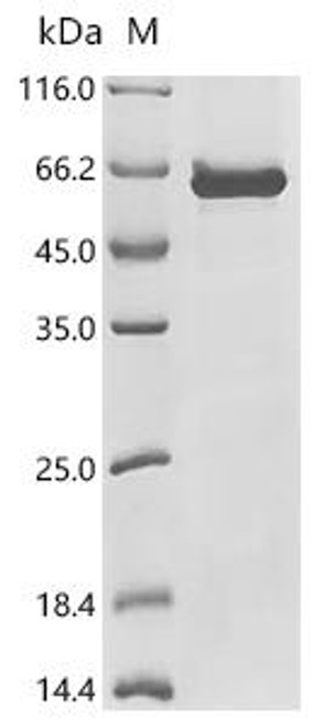 Recombinant Bunyavirus snowshoe hare Envelopment polyprotein (GP), partial (CSB-EP361398BNQ)