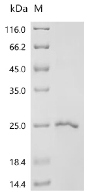 Recombinant Porcine reproductive and respiratory syndrome virus Glycoprotein 4 (GP4), partial (CSB-EP368832PYZ1)