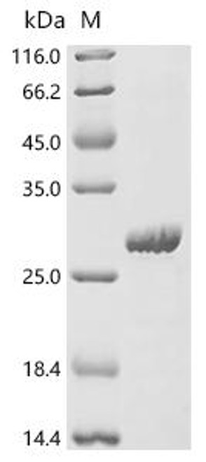 Recombinant Human Endogenous retrovirus group K member 113 Pro protein (HERVK_113) (CSB-EP351212HU)