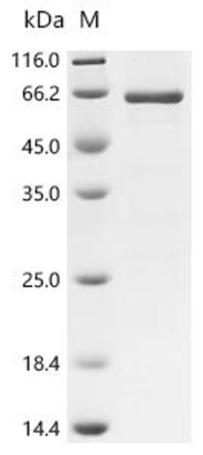 Recombinant Human Hexokinase HKDC1 (HKDC1), partial (CSB-EP647983HU)