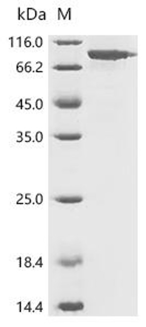 Recombinant Human Biotin--protein ligase (HLCS) (CSB-EP010518HU)