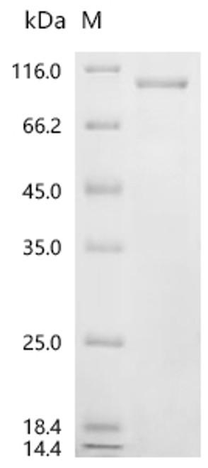 Recombinant Rat Heat shock protein HSP 90-alpha (Hsp90aa1) (CSB-EP010802RAb1)