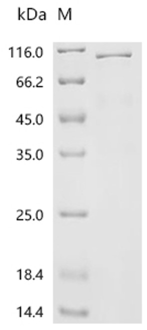 Recombinant Mouse Heat shock protein HSP 90-beta (Hsp90ab1) (CSB-EP010808MOb1)
