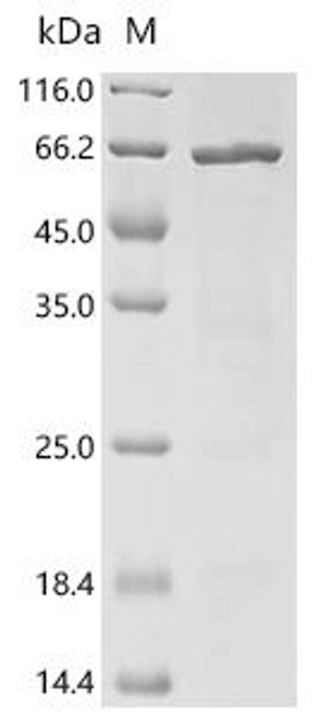 Recombinant Bartonella henselae Probable periplasmic serine endoprotease DegP-like (htrA) (CSB-EP345817BSG)