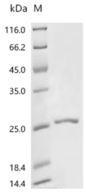 Recombinant Human Interleukin-2 (IL2) (CSB-EP011629HUd7)
