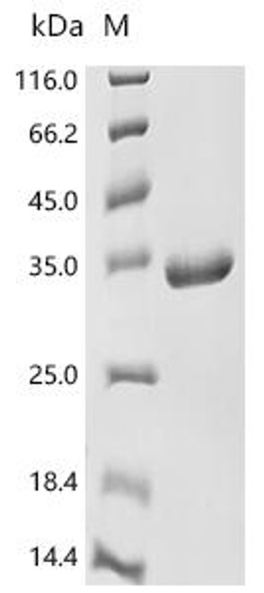 Recombinant Human Ras GTPase-activating-like protein IQGAP1 (IQGAP1), partial (CSB-EP011800HU)