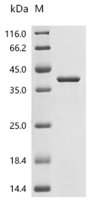 Recombinant Human Integrin alpha-IIb (ITGA2B), partial (CSB-EP011865HUa0)