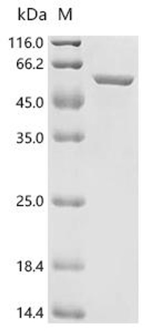 Recombinant Mouse Keratin, type I cytoskeletal 17 (Krt17) (CSB-EP889547MO)