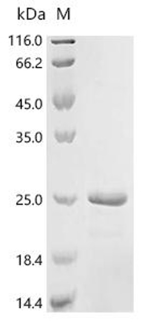 Recombinant Mouse Galectin-9 (Lgals9), partial (CSB-EP012895MO1(F))
