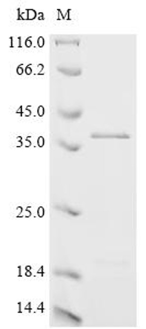 Recombinant Epstein-Barr virus Latent membrane protein 1 (LMP1), partial (CSB-EP355987EFA1)