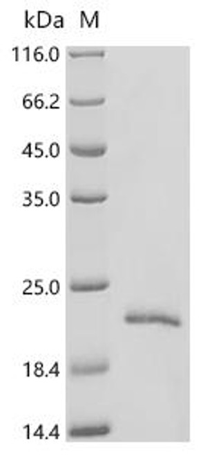 Recombinant Diaphorina citri General odorant-binding protein 3 (LOC103507602) (CSB-EP6894INT)