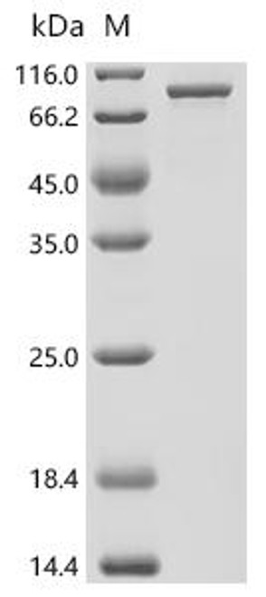 Recombinant Mouse Leucine zipper putative tumor suppressor 1 (Lzts1) (CSB-EP013291MO)