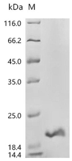 Recombinant Human MHC class I polypeptide-related sequence B (MICB), partial (CSB-EP5607HU1)