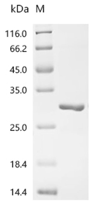 Recombinant Human MHC class I polypeptide-related sequence B (MICB), partial (CSB-EP5607HU2a0)