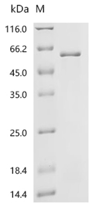 Recombinant Mouse Matrix metalloproteinase-14 (Mmp14), partial (CSB-EP014661MO1)