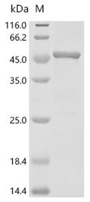 Recombinant Human Mevalonate kinase (MVK) (CSB-EP015247HU)