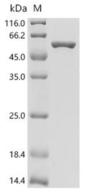 Recombinant Mouse Major vault protein (Mvp), partial (CSB-EP015248MO)