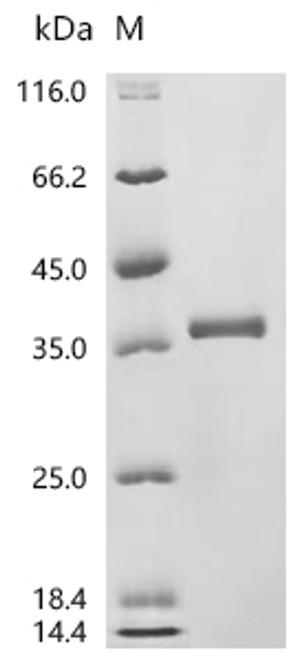 Recombinant Macaca fascicularis tumor-associated calcium signal transducer 2 (TACSTD2), partial (CSB-EP6581MOV)