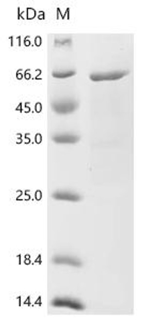 Recombinant Taxus cuspidata Tubulin beta chain (CSB-EP6687FTB) Recombinant Taxus cuspidata Tubulin beta chain (CSB-EP6687FTB)