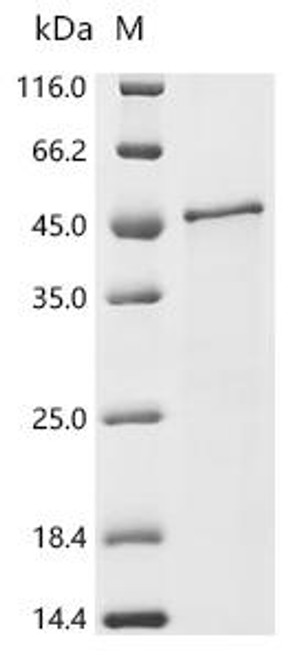 Recombinant Prunus persica Uncharacterized protein (CSB-EP6299EZK)