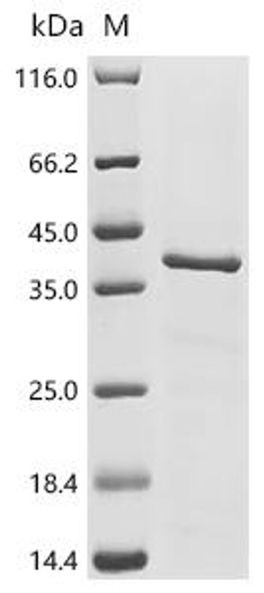 Recombinant Rotavirus A Outer capsid glycoprotein VP7 (CSB-EP318897RGU) Recombinant Rotavirus A Outer capsid glycoprotein VP7 (CSB-EP318897RGU)