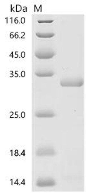 Recombinant Platanus acerifolia Putative invertase inhibitor (CSB-EP818103PGAT) Recombinant Platanus acerifolia Putative invertase inhibitor (CSB-EP818103PGAT)