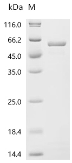 Recombinant Rat RNA-binding protein Nova-1 (Nova1) (CSB-EP772155RA)