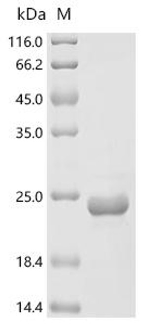 Recombinant Sitophilus zeamais Odorant binding protein 1 (OBP1), partial (CSB-EP6888INQ)