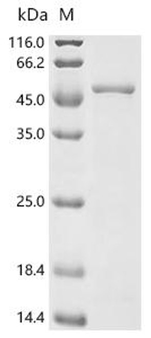 Recombinant Chlamydia trachomatis Major outer membrane porin, serovar H (ompA) (CSB-EP321117DSA) Recombinant Chlamydia trachomatis Major outer membrane porin, serovar H (ompA) (CSB-EP321117DSA)