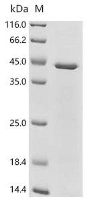 Recombinant Feline calicivirus Capsid protein VP1, partial (CSB-EP329722FAE) Recombinant Feline calicivirus Capsid protein VP1, partial (CSB-EP329722FAE)