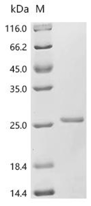 Recombinant Pseudomonas phage phi6 Major outer capsid protein (P8) (CSB-EP362169PUV) Recombinant Pseudomonas phage phi6 Major outer capsid protein (P8) (CSB-EP362169PUV)