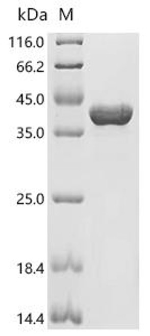 Recombinant Pseudomonas aeruginosa Type III secretion system protein (pcrV) (CSB-EP6908EZW) Recombinant Pseudomonas aeruginosa Type III secretion system protein (pcrV) (CSB-EP6908EZW)