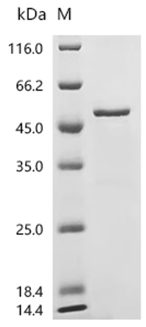 Recombinant Human Choline-phosphate cytidylyltransferase A (PCYT1A) (CSB-EP017654HU) Recombinant Human Choline-phosphate cytidylyltransferase A (PCYT1A) (CSB-EP017654HU)