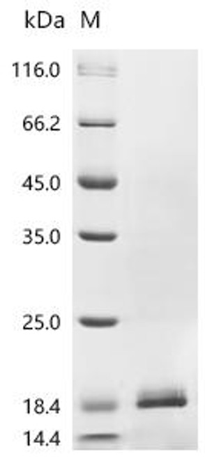 Recombinant Human Platelet factor 4 (PF4) (CSB-EP017809HU)