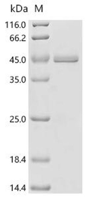 Recombinant Salmonella typhi Secreted effector protein pipB2 (pipB2) (CSB-EP841656SWW)