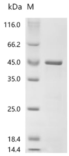 Recombinant Mycobacterium tuberculosis PPE family immunogenic protein PPE68 (PPE68) (CSB-EP748521MVZ)