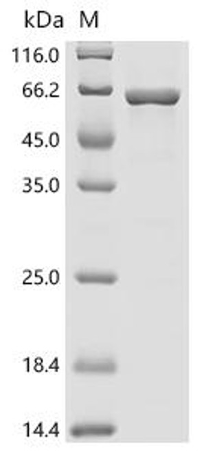 Recombinant Arabidopsis thaliana Protoporphyrinogen oxidase 2,chloroplastic/mitochondrial (PPOX2) (CSB-EP6910DOA)