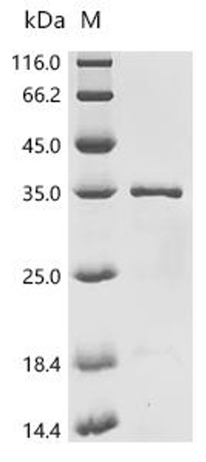 Recombinant Human Transcription factor p65 (RELA), partial (CSB-EP0398HUc7)
