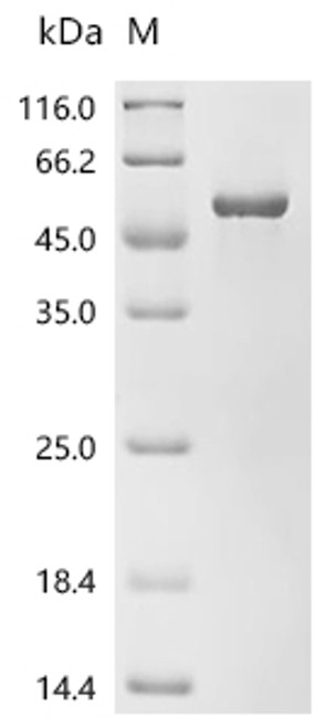 Recombinant Human N-acylglucosamine 2-epimerase (RENBP) (CSB-EP019562HU)