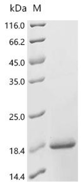 Recombinant Mouse Resistin-like alpha (Retnla) (CSB-EP880616MO)
