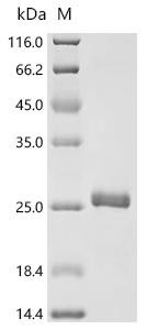 Recombinant Human immunodeficiency virus type 1 group M subtype B Protein Rev (rev) (CSB-EP356309HKP)