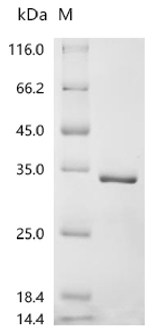 Recombinant Human Small ribosomal subunit protein eS27 (RPS27) (CSB-EP020419HUa2)