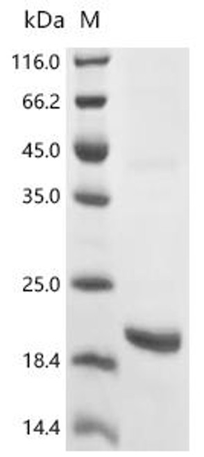 Recombinant Human Sphingosine 1-phosphate receptor 5 (S1PR5), partial (CSB-EP867132HU1)