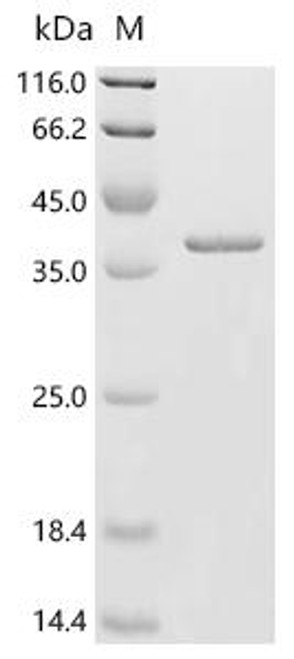 Recombinant Mouse Syntaxin-17 (Stx17), partial (CSB-EP861508MO1)