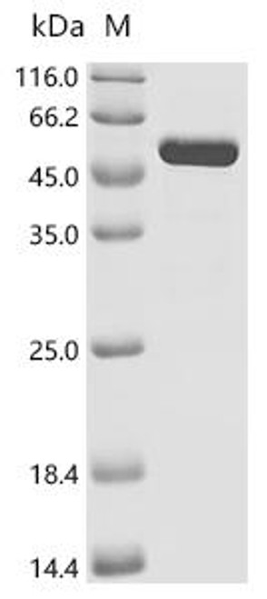 Recombinant Bartonella quintana Dihydrolipoyllysine-residue succinyltransferase component of 2-oxoglutarate dehydrogenase complex (sucB) (CSB-EP753259BSH)