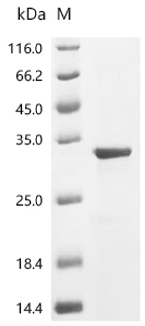 Recombinant Human Tumor necrosis factor ligand superfamily member 10 (TNFSF10), partial (CSB-EP023985HU1)