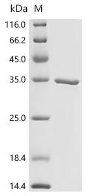 Recombinant Mouse Three prime repair exonuclease 2 (Trex2) (CSB-EP882612MO)